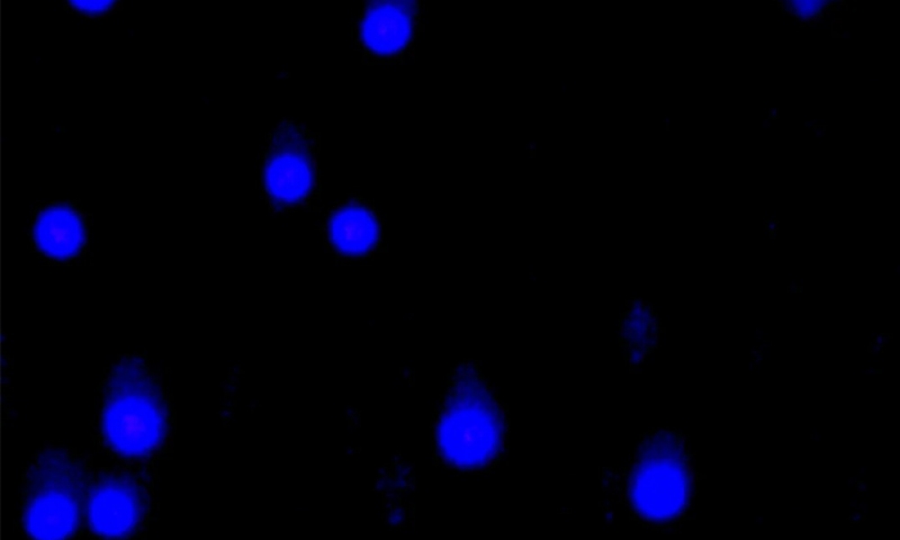 彗星实验（Comet assay）